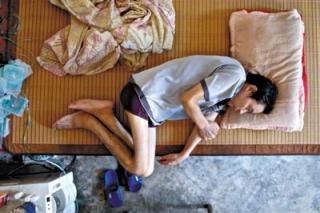 湖南尘肺乡调查：病人腿瘦如木棍 多人痛苦自杀.jpg